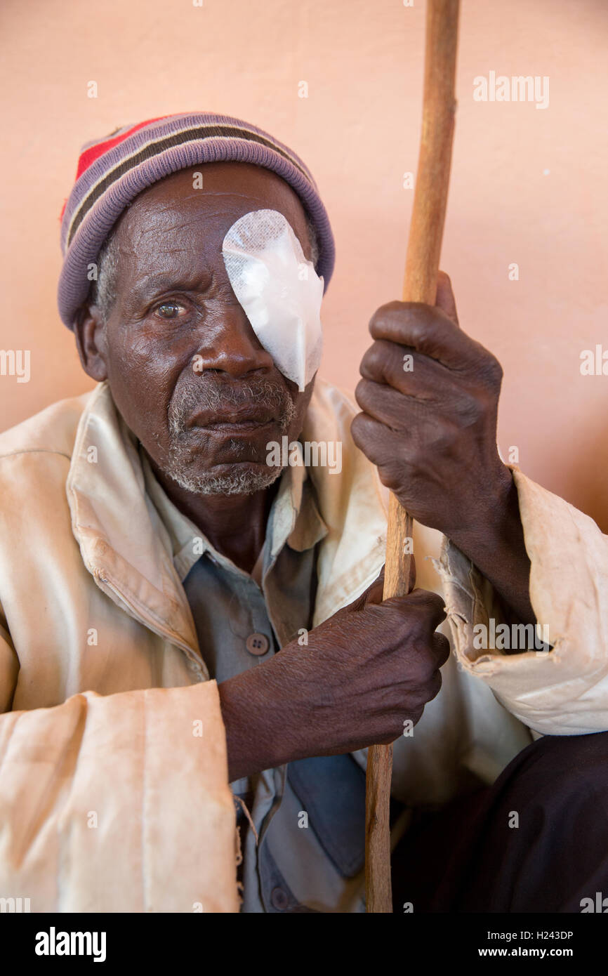 Ribaue Hospital, Ribaue,  Nampula Province, Mozambique, August 2015: Sabonet Maulechane from Malema about to have his bandage removed after cataract operations the day before. . Photo by Mike Goldwater Stock Photo