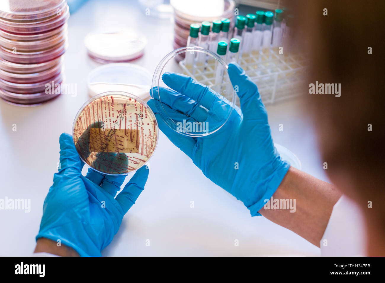 Hands holding a culture plate testing for the presence of Escherichia coli bacteria by looking at antibiotic resistance. Stock Photo