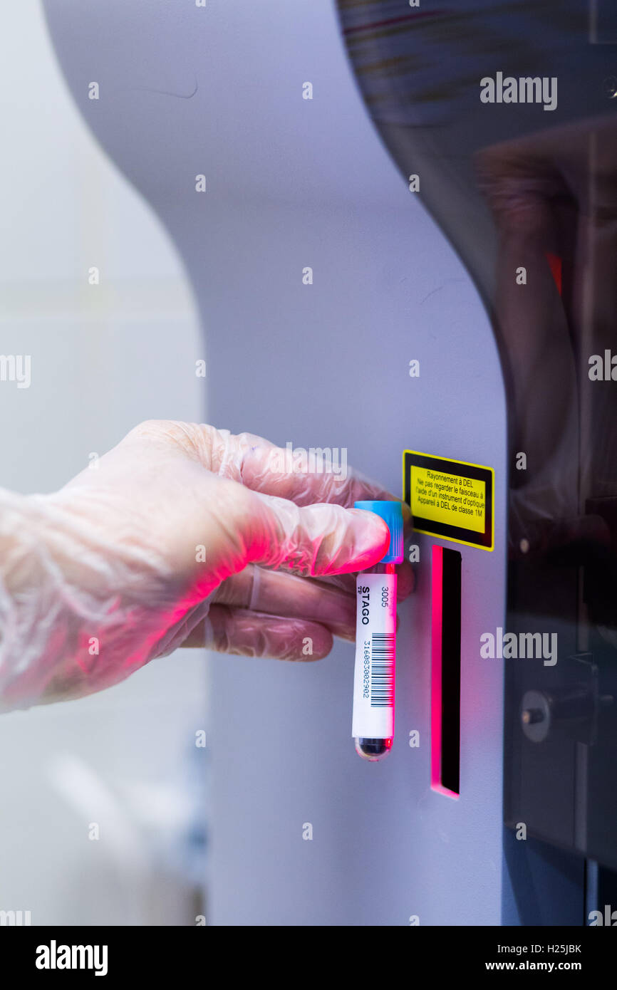 Laboratory Hematology, Here, computer recording of a blood sample. Stock Photo