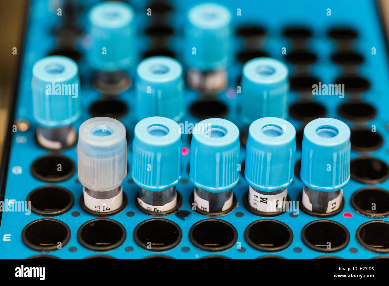 Laboratory Hematology, Automaton analysis blood samples. Stock Photo