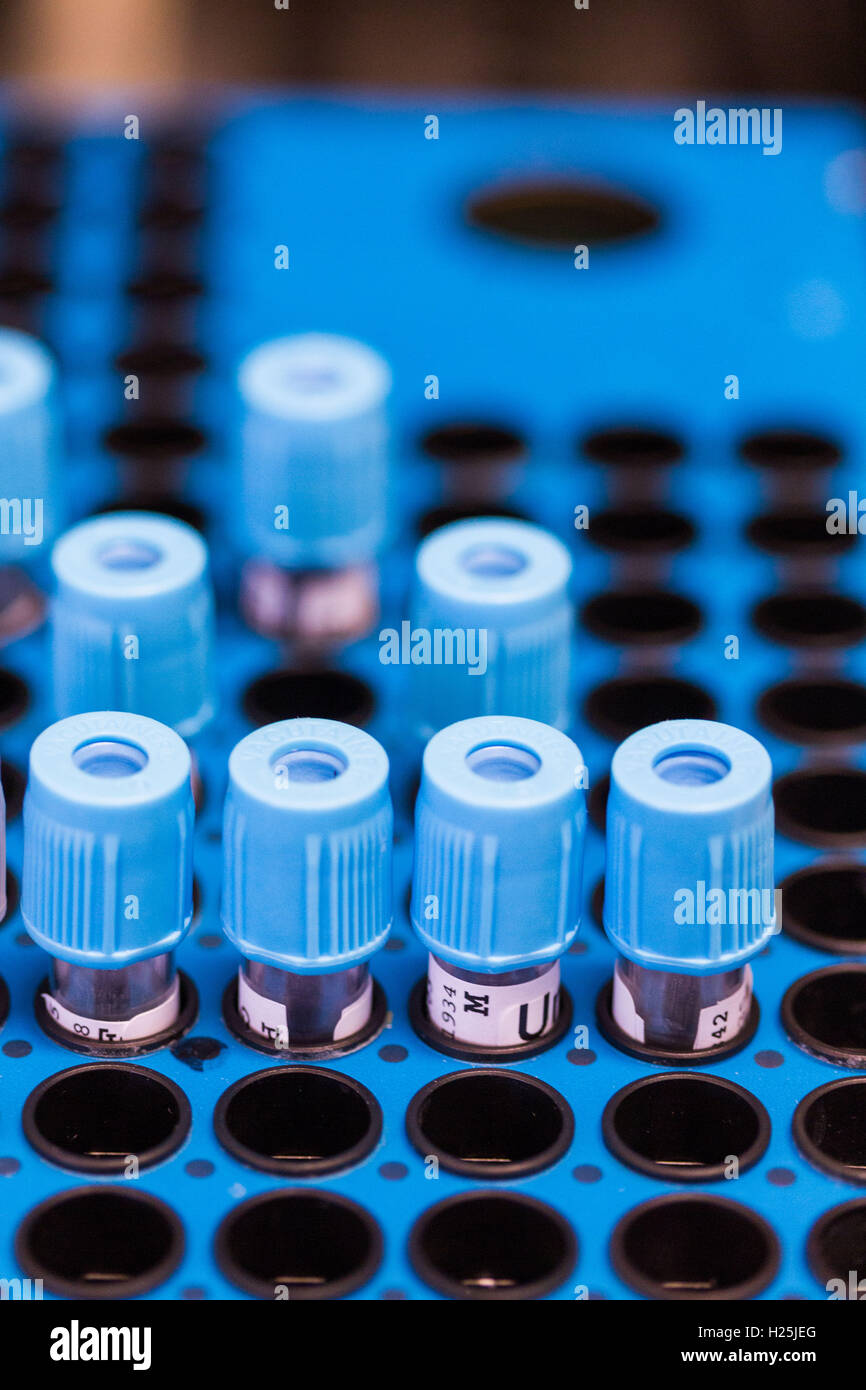 Laboratory Hematology, Automaton analysis blood samples. Stock Photo