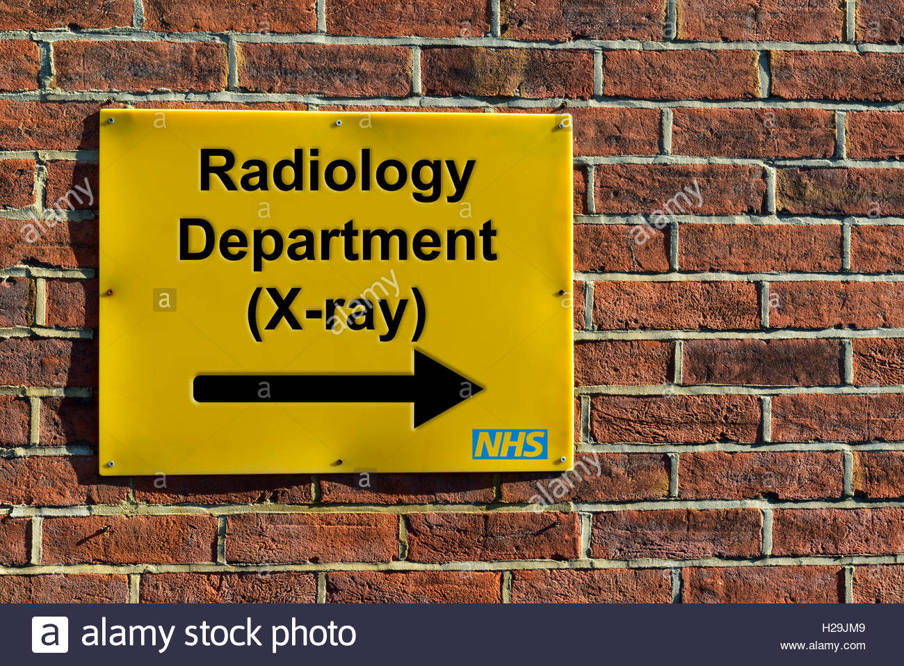 Radiology Department (Xray), NHS wall mounted direction sign Stock