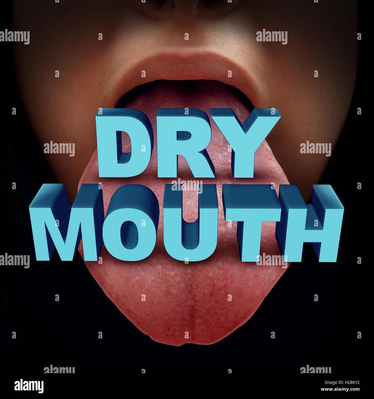 Dry mouth medical concept or xerostomia due to lack of saliva as a human tongue with  text as a health care symbol for oral disease or illness with 3D illustration elements. Stock Photo