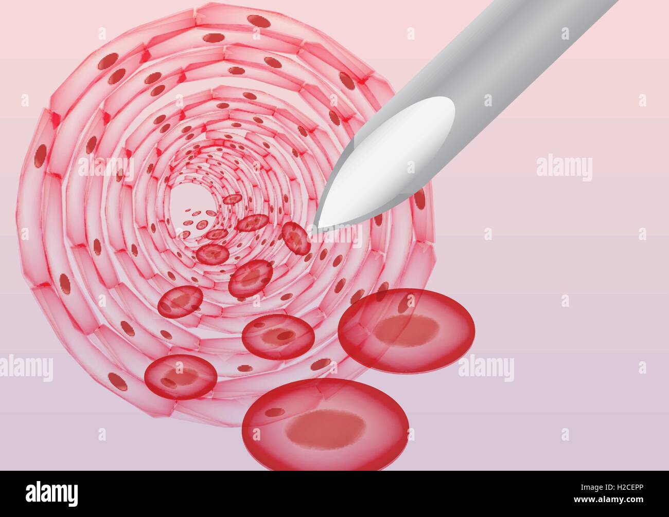 Oil Injection Bloodstream Injection in the Bloodstream with a Syringe from the Insid Stock Vector ...