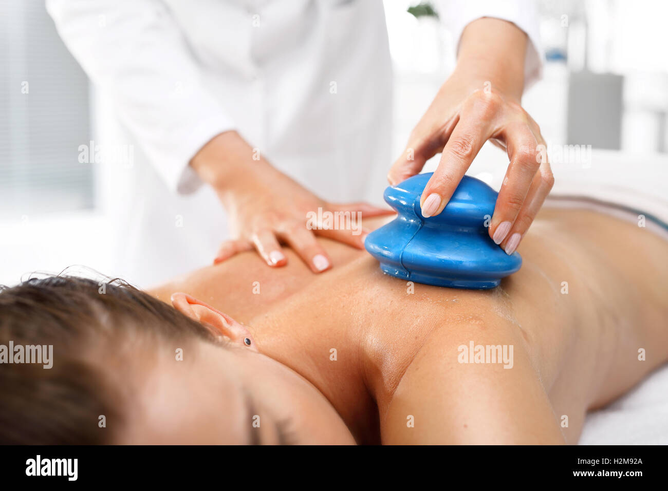 Chinese cupping massage.Alternative medicine. Massage Masseur massaging her back rubber Chinese bubble. Stock Photo