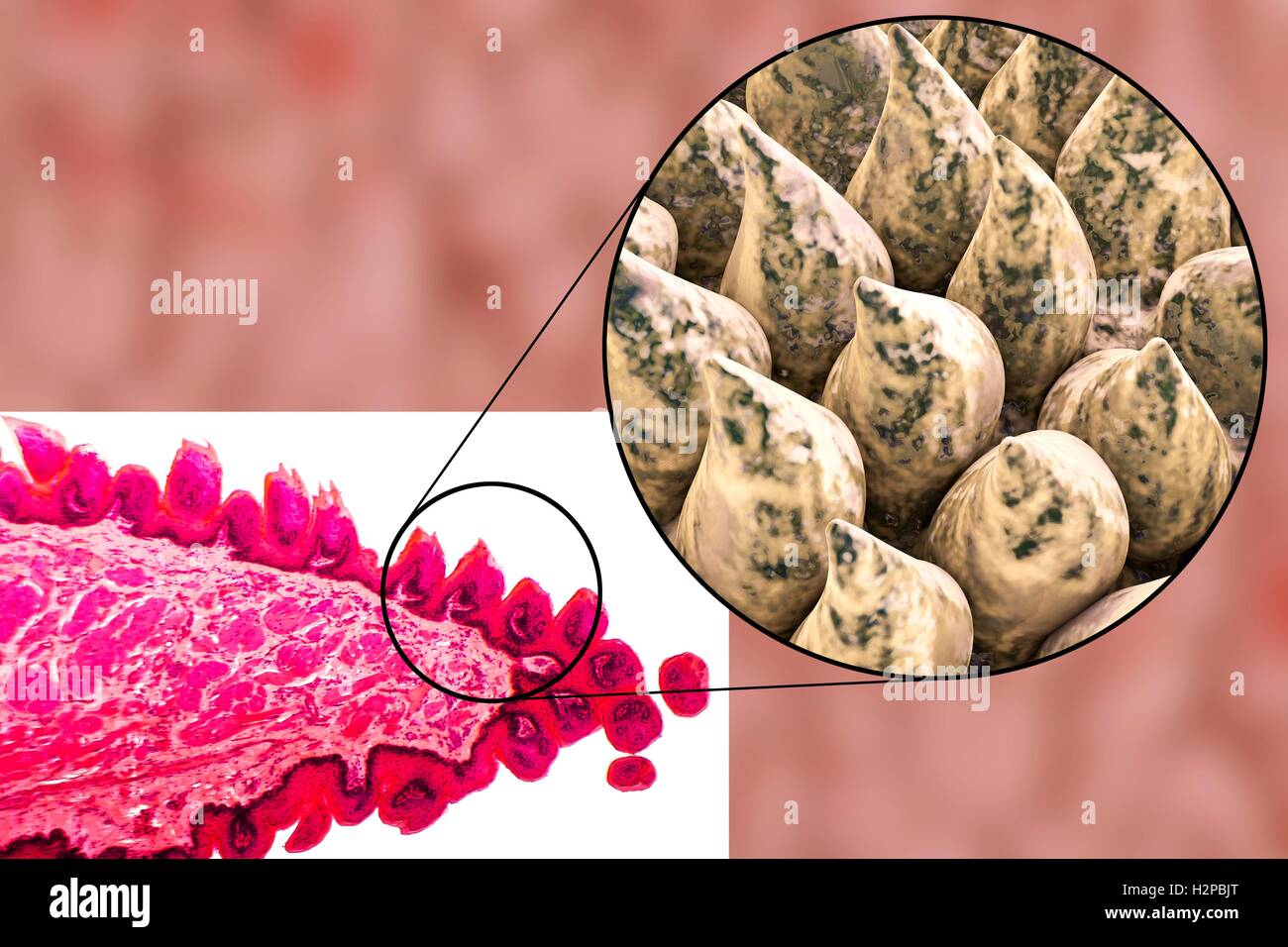 Tongue surface, light micrograph and computer illustration. Filiform papillae (cone-shaped) on the surface of the tongue. Filiform papillae contain nerve endings that transmit tactile (touch) information to the brain. Stock Photo