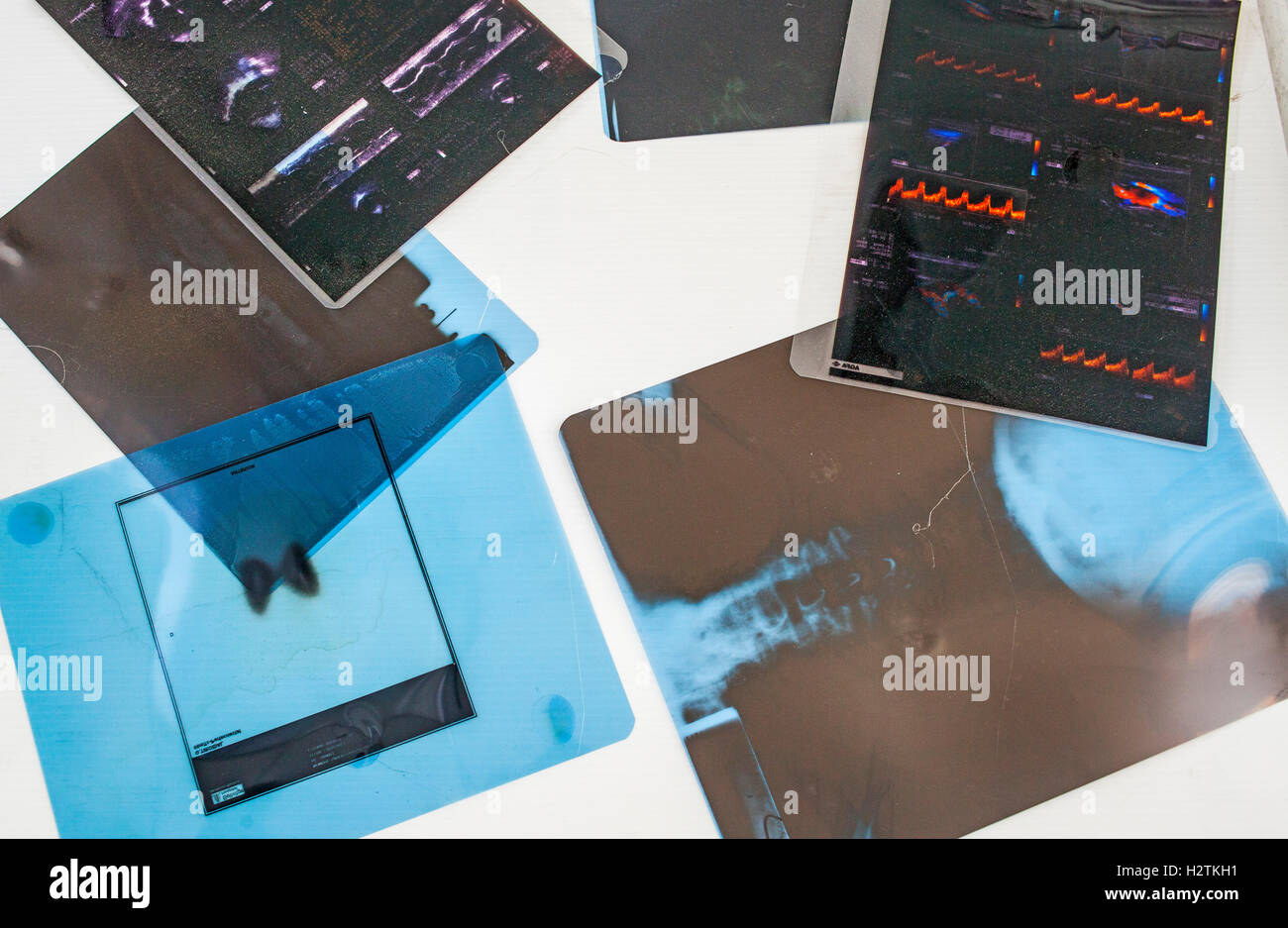 Radiography storage to recycle, recycling center Stock Photo