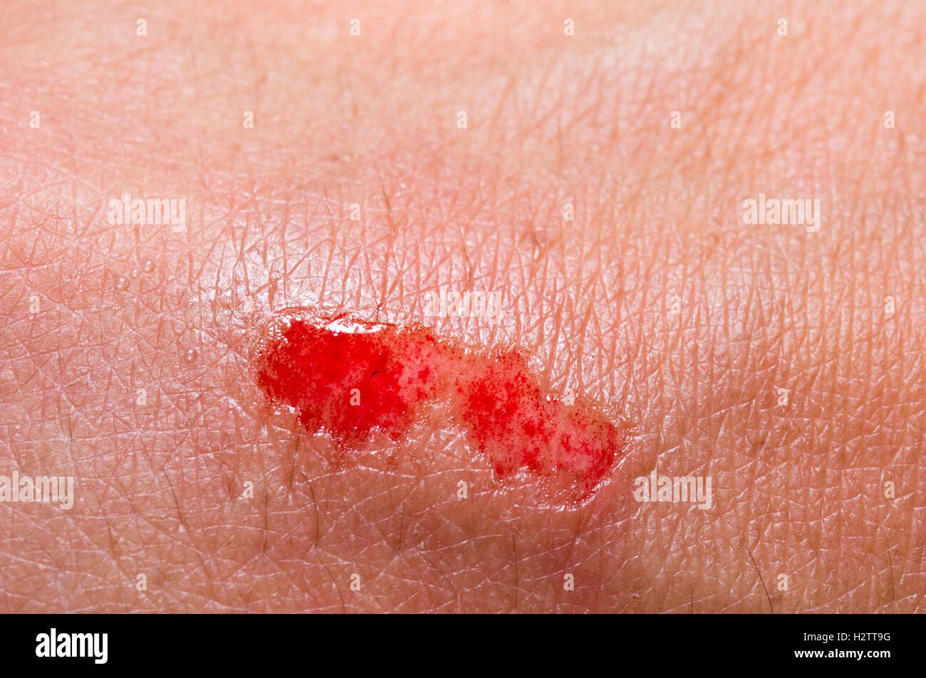 Scrape in the hand. Stock Photo