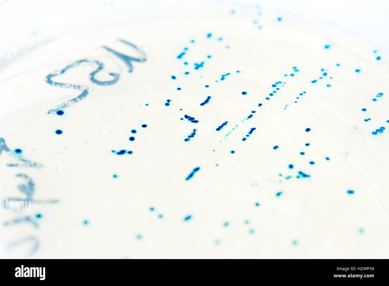 Agar plate with bacterial colonies transformed with plasmid DNA Stock Photo