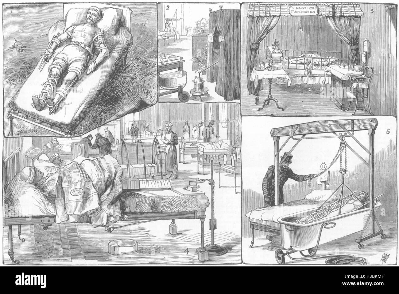 HOSPITALS Extempore dressing;Ward Tent kit Guy's,St Mary's;Bath lift Mddx 1881. The Graphic Stock Photo