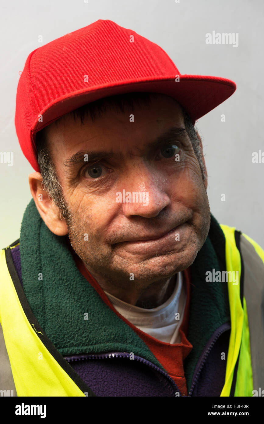 Middle aged man with learning difficulties suffering from incurable throat cancer Stock Photo