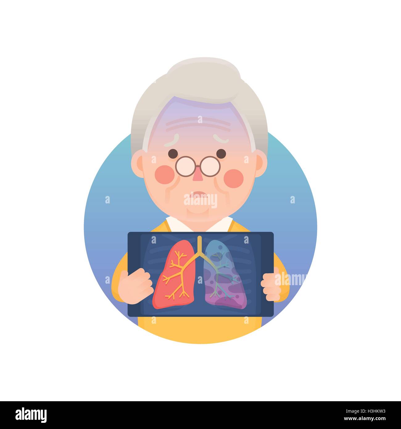 Vector Illustration of Old Man Holding X-ray Image Showing Lung Cancer Problem, Cartoon Character Stock Vector