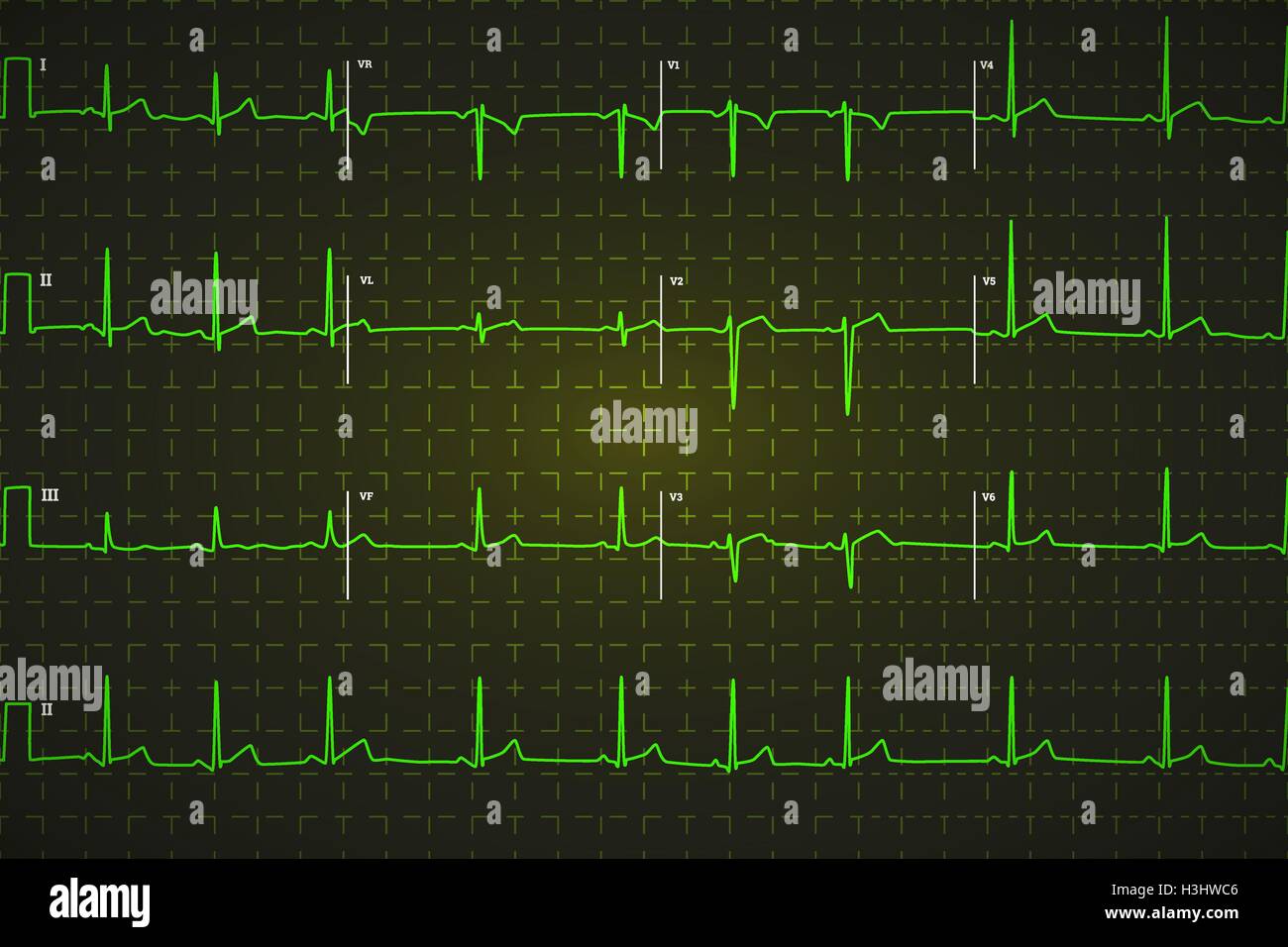 Typical human electrocardiogram, bright green graph on dark background Stock Vector