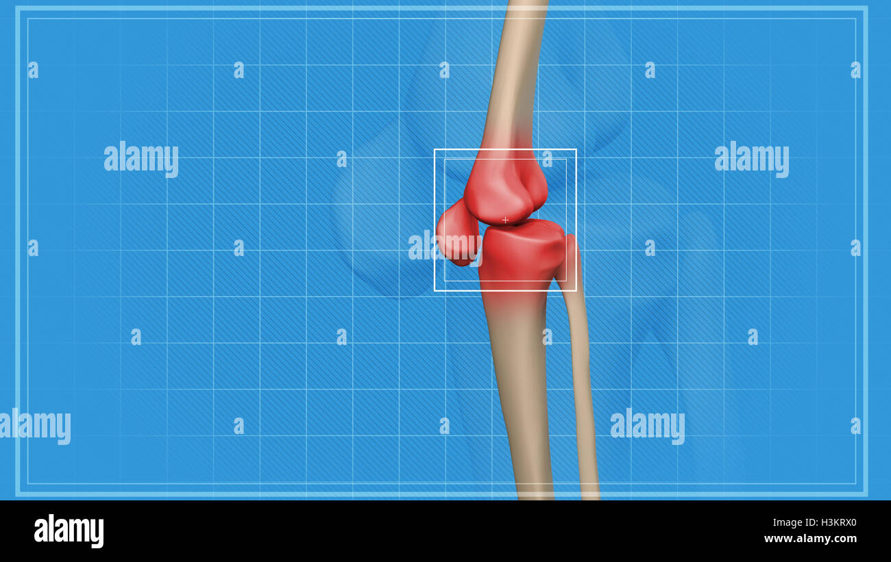 Human knee pain with the anatomy of a skeleton leg Stock Photo - Alamy