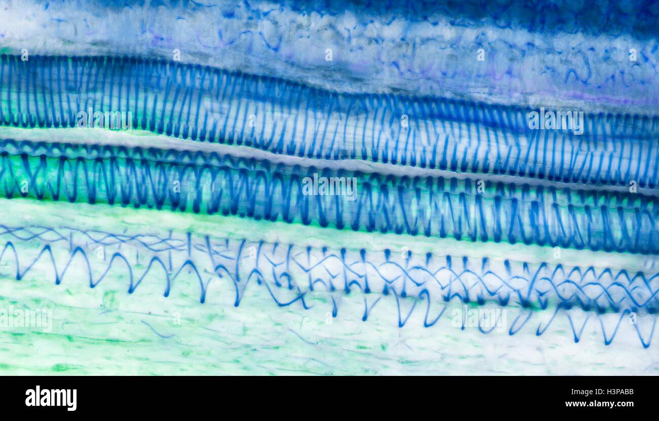 Xylem tissue. Light micrograph (LM) of a section through sunflower(helianthus annuus) tissue showing spiral tracheids, a type of xylem. Tracheids are long tubular cells with lignin, a material that provides support, in the cell walls. Spiral thickening of the cells can be seen. Tracheids conduct water from the roots of a plant along the stems to the leaves. Magnification: x210 when printed 10cm wide. Stock Photo