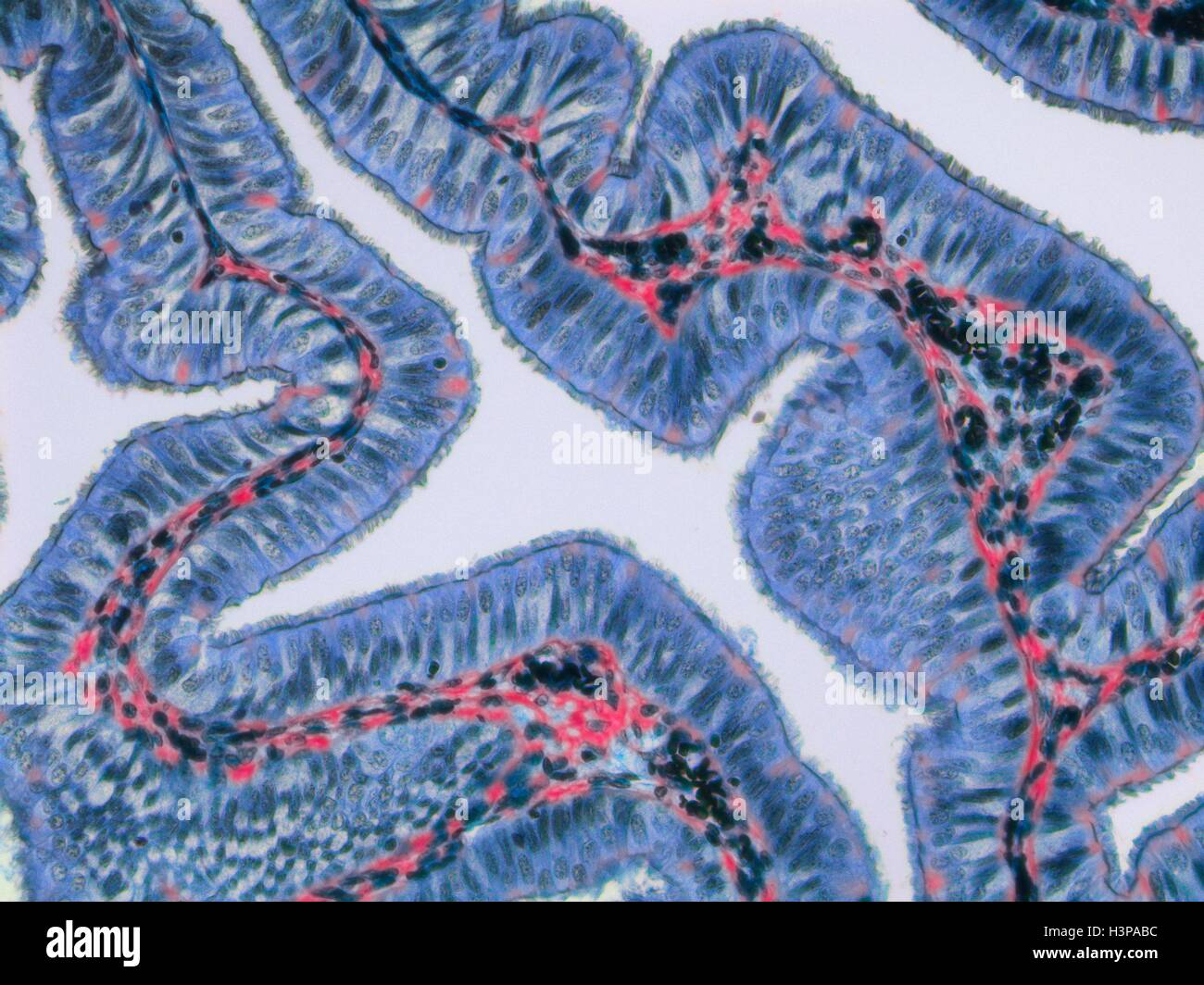 Fallopian tube. Light micrograph (LM).The fallopian tube, or oviduct, conveys the egg from the ovary to the uterus. Ciliated columnar epithelium is blue, connective tissue is red and blood vessels are black. Magnification: x120 when printed at 10 centimetres wide. Stock Photo