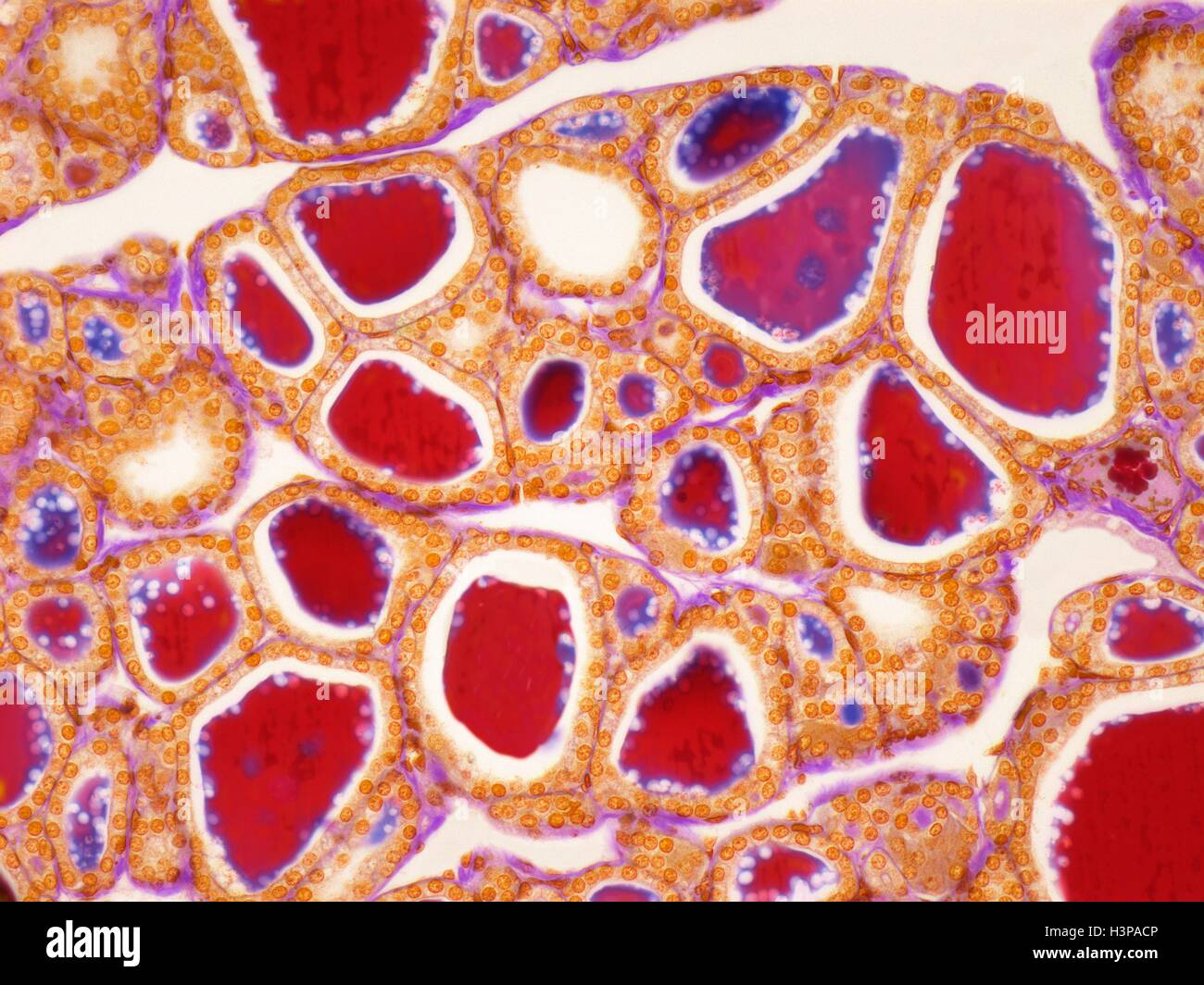 Thyroid follicle hi-res stock photography and images - Alamy