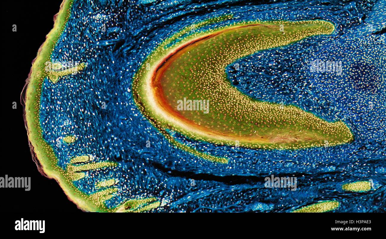 Developing nail. Light micrograph (LM) of longitudinal section through a fetal finger tip to show the developing nail. The large area of green-yellow nail bed epithelium is tipped by the developing nail. Blue connective tissue (dermis) forms the bulk of the image. Yellow stratified squamous epithelium of the skin is far left. Magnification: x15 when printed at 10 centimetres wide. Stock Photo