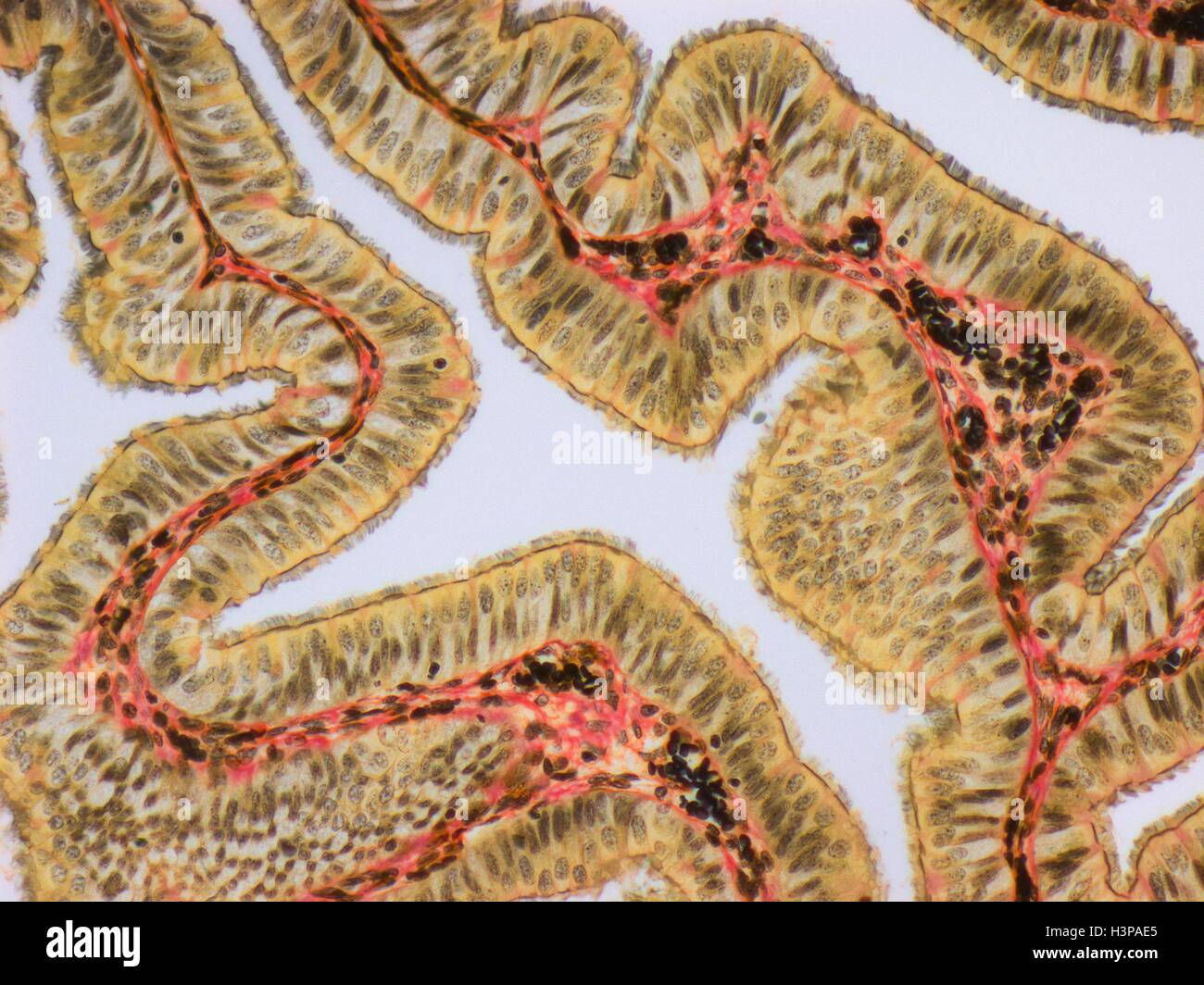 Fallopian tube. Light micrograph (LM).The fallopian tube, or oviduct, conveys the egg from the ovary to the uterus. Ciliated columnar epithelium is yellow, connective tissue is red and blood vessels are black. Magnification: x120 when printed at 10 centimetres wide. Stock Photo