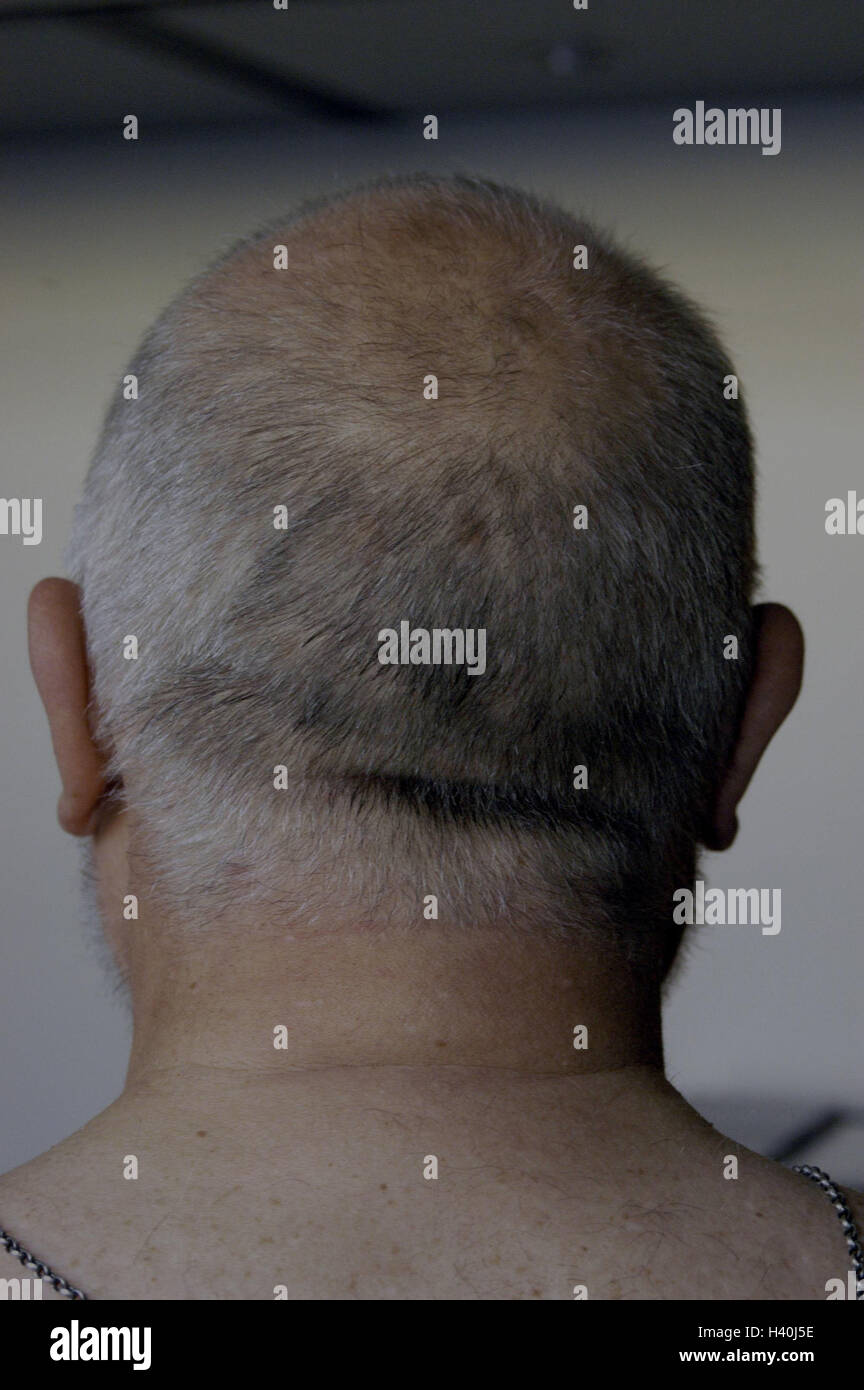 Man Thickly Detail Back The Head Model Released Very Close
