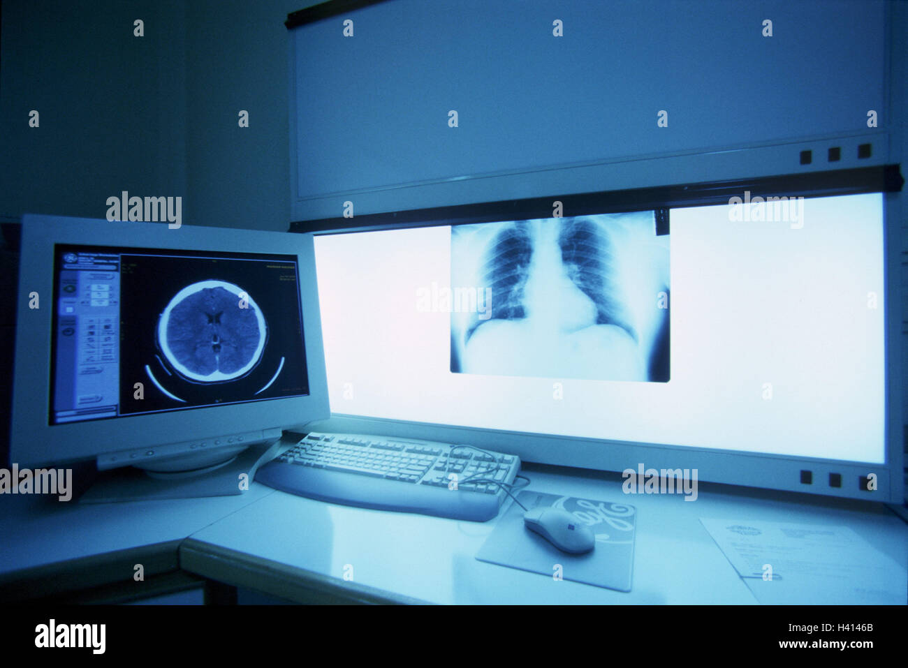 Hospital, light blackboard, xray, Chest, computer tomogram, brain