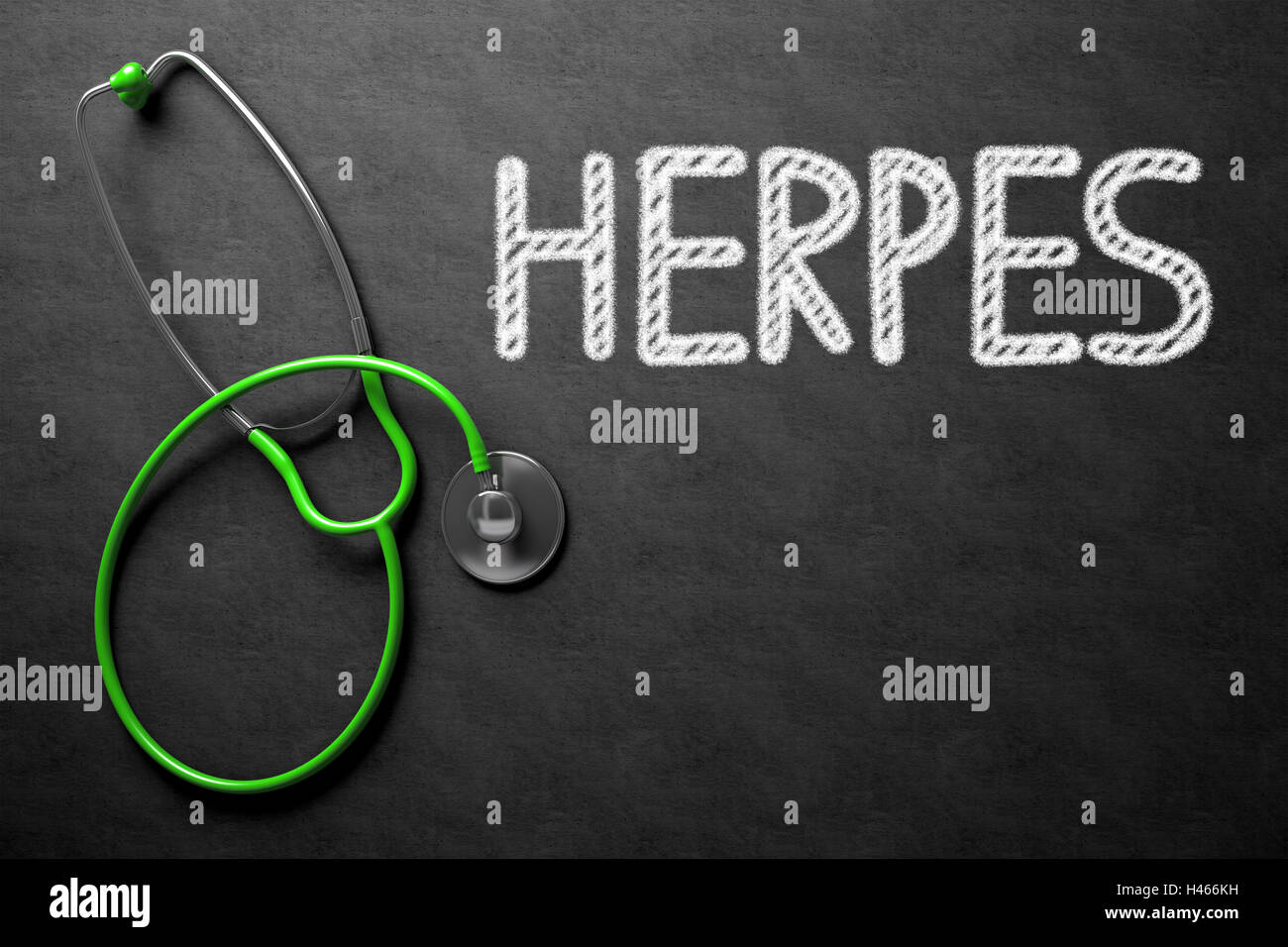 Herpes Concept on Chalkboard. 3D Illustration. Stock Photo