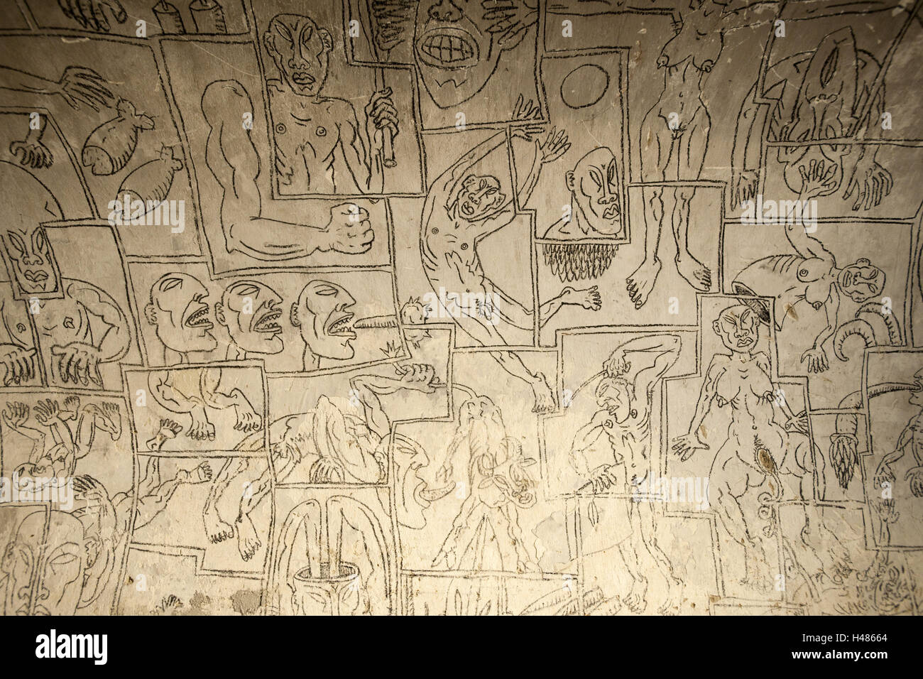 Display of conjoined twins specimen