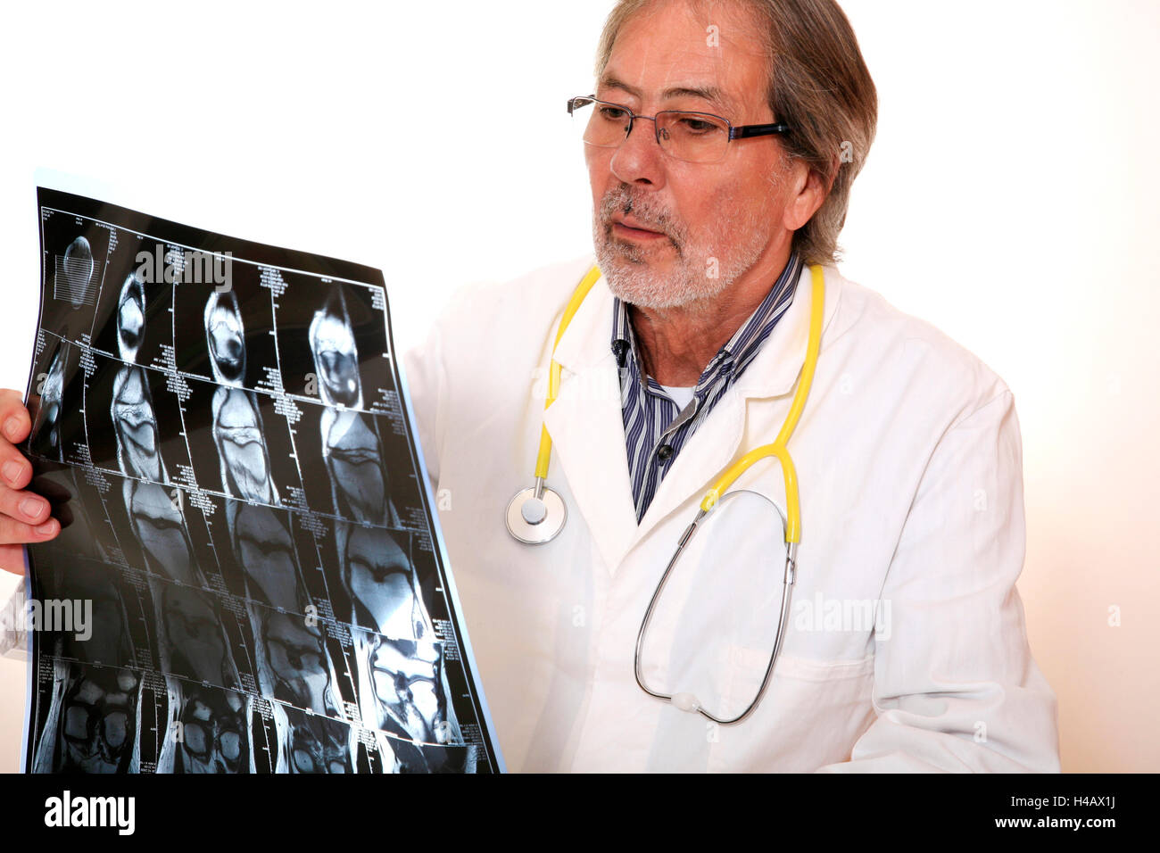 Doctor, X-ray picture, knee, diagnosis Stock Photo
