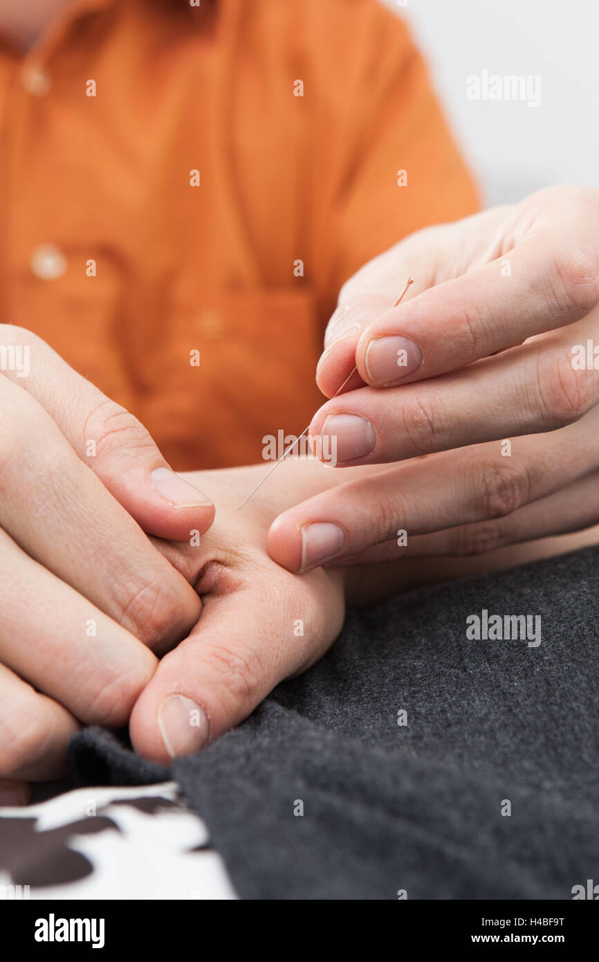 Acupuncture, hand, needle, acupuncture needle Stock Photo Alamy