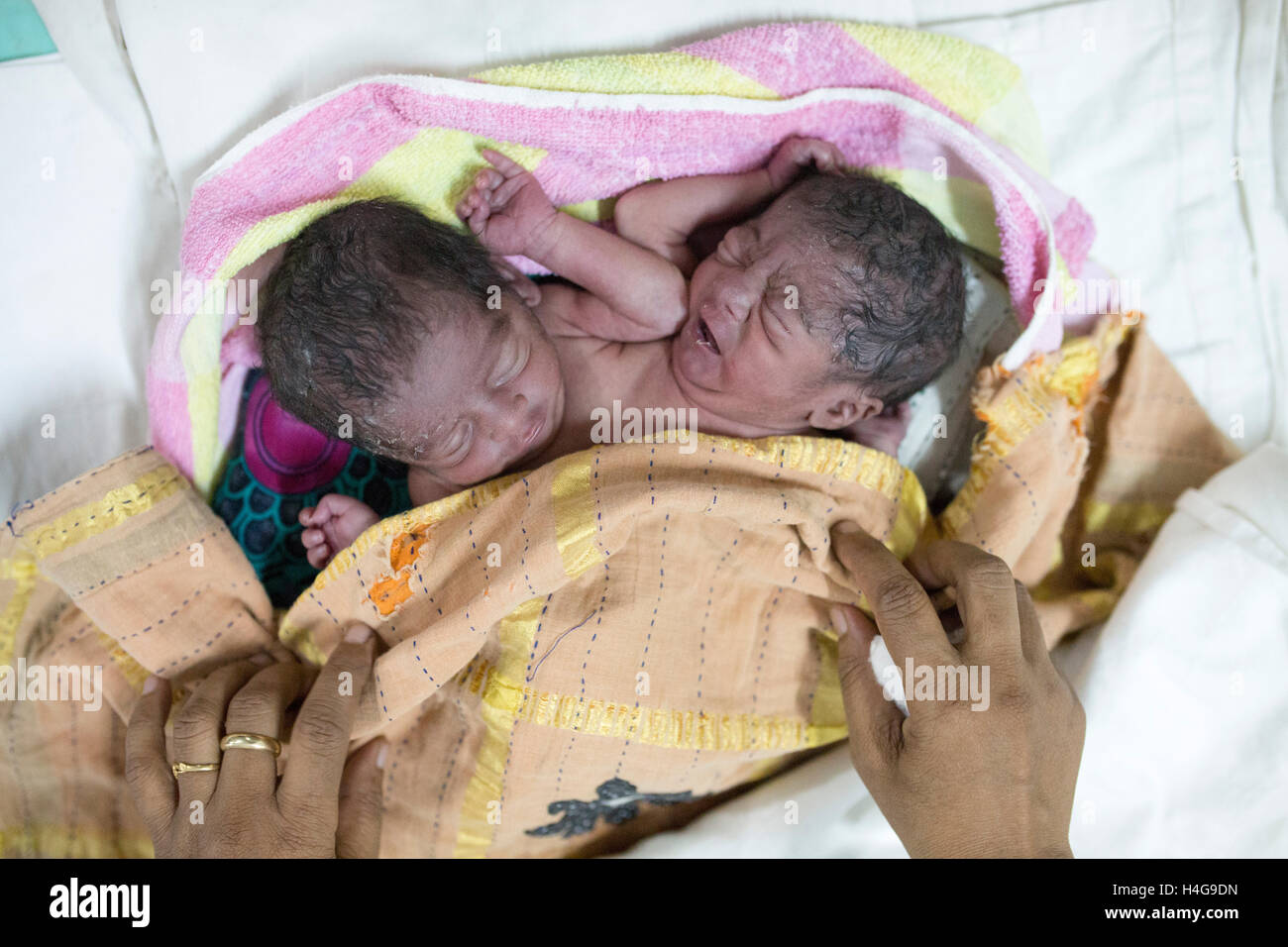 Dhaka, Bangladesh. 15th October, 2016. Parents were allegedly abandoned the conjoined twins at the Dhaka Medical College Hospital in Dhaka, Bangladesh, on October 15, 2016.  DMCH (Dhaka Medical College Hospital) Deputy Director Khaja Abdul Gafursaid, 'The kids, with two heads, four hands and two legs, were born in an unknown clinic in Dhaka and were taken to the DMCH on Friday night. Later, their parents fled leaving the twins at the infant ward.” Credit:  zakir hossain chowdhury zakir/Alamy Live News Stock Photo