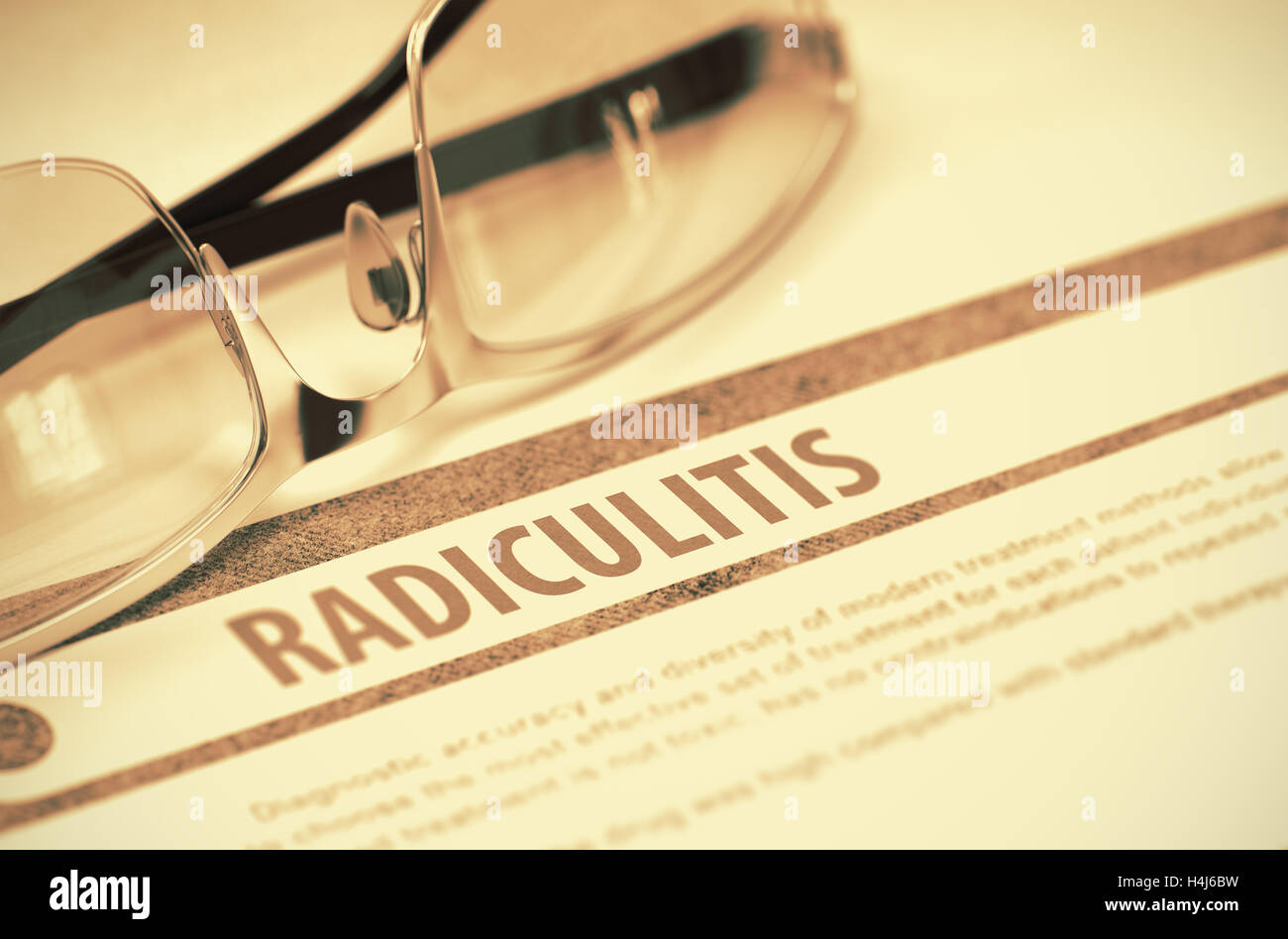 What is radiculitis, how does it differ from osteochondrosis, and how to treat it What is radiculitis, how does it differ from osteochondrosis, and how to treat it
