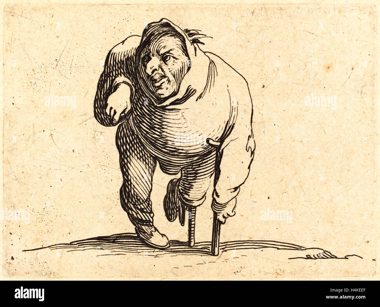 One leg one crutch hires stock photography and images Alamy