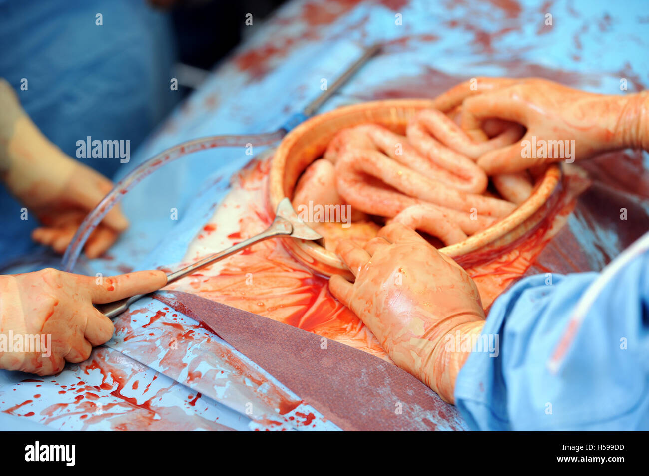 A simulated surgical operation with a film and tv dummy made by the make-up and prosthetics expert Max Campbell as a teaching ai Stock Photo