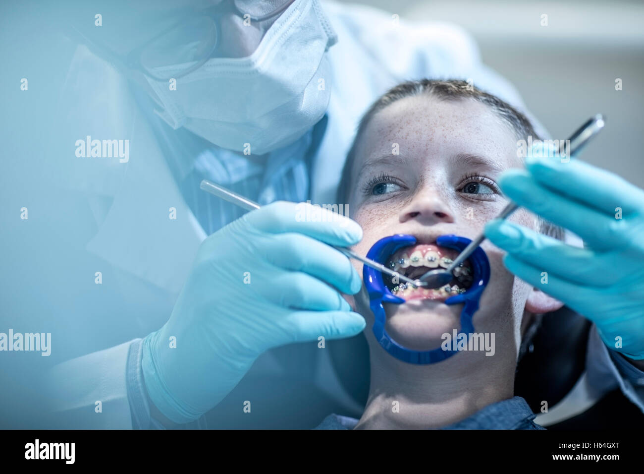 Boy in dental surgery receiving orthodontic treatment Stock Photo Alamy