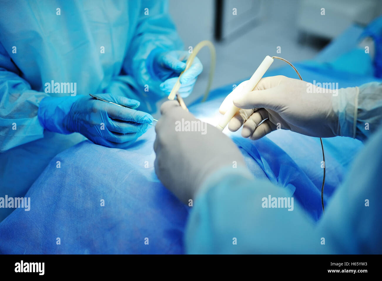 hand surgeon makes an operation closeup. surgical instruments Stock Photo Alamy