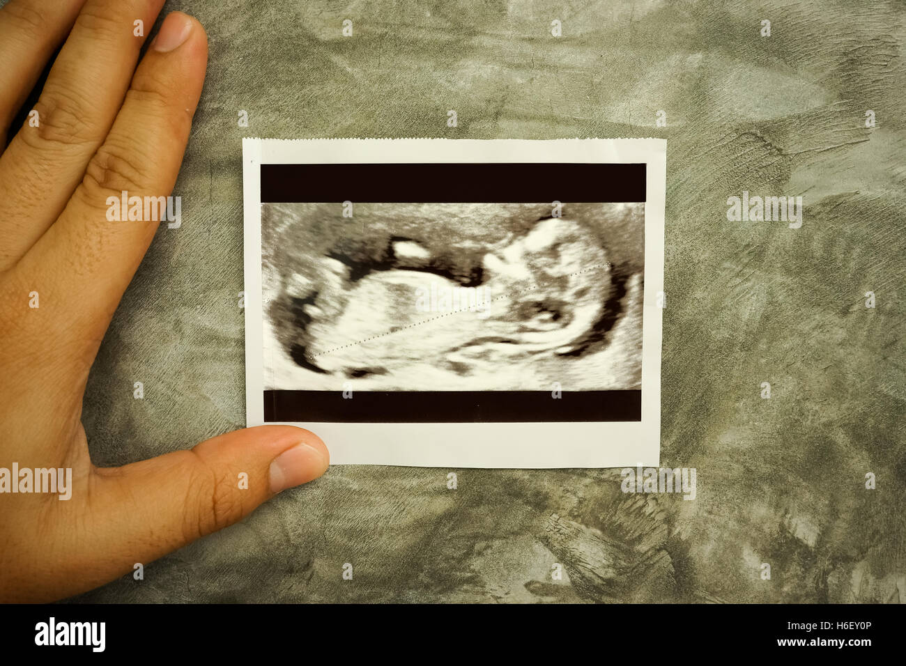 Ultrasound Scan Photo in concrete wall babkground Stock Photo Alamy