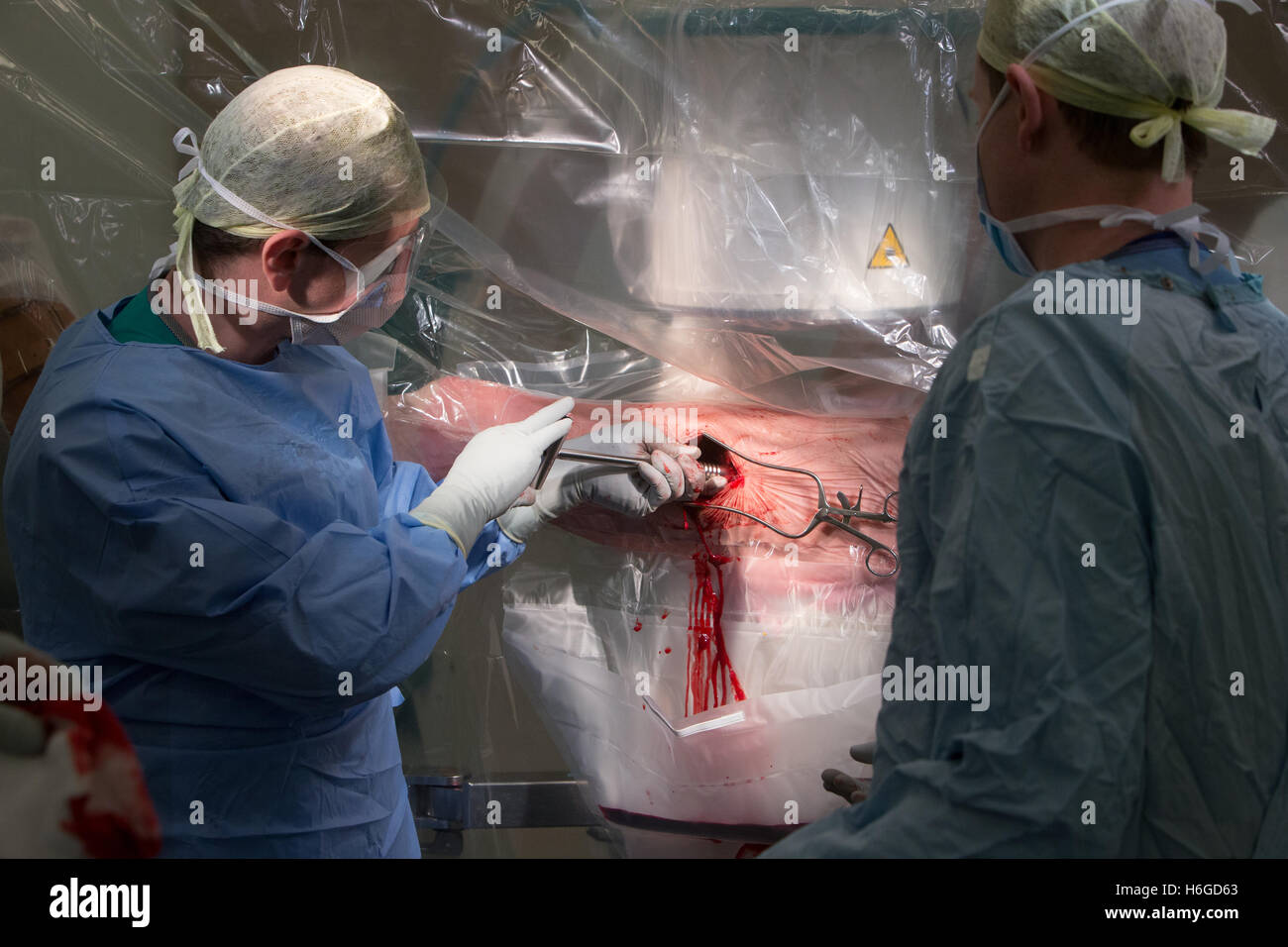 Surgeons in the theatre working on a left decompression hip screw operation more commonly known as a hip replacement Stock Photo