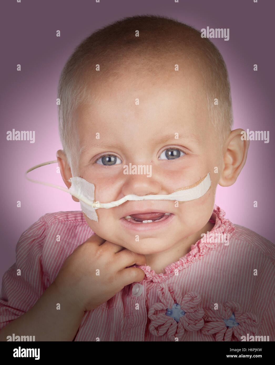 Adorable Baby Without Hair Beating The Disease Isolated On White