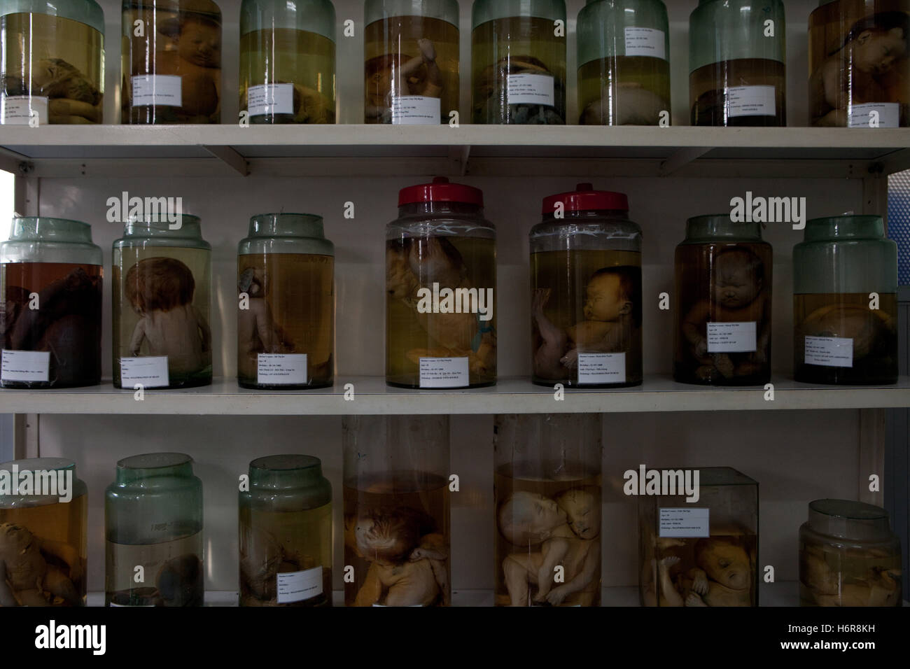 Jars of foetuses with defects from exposure to Agent Orange Dioxin used in the Vietnam War, Tu Do Hospital Ho Chi Minh city Stock Photo