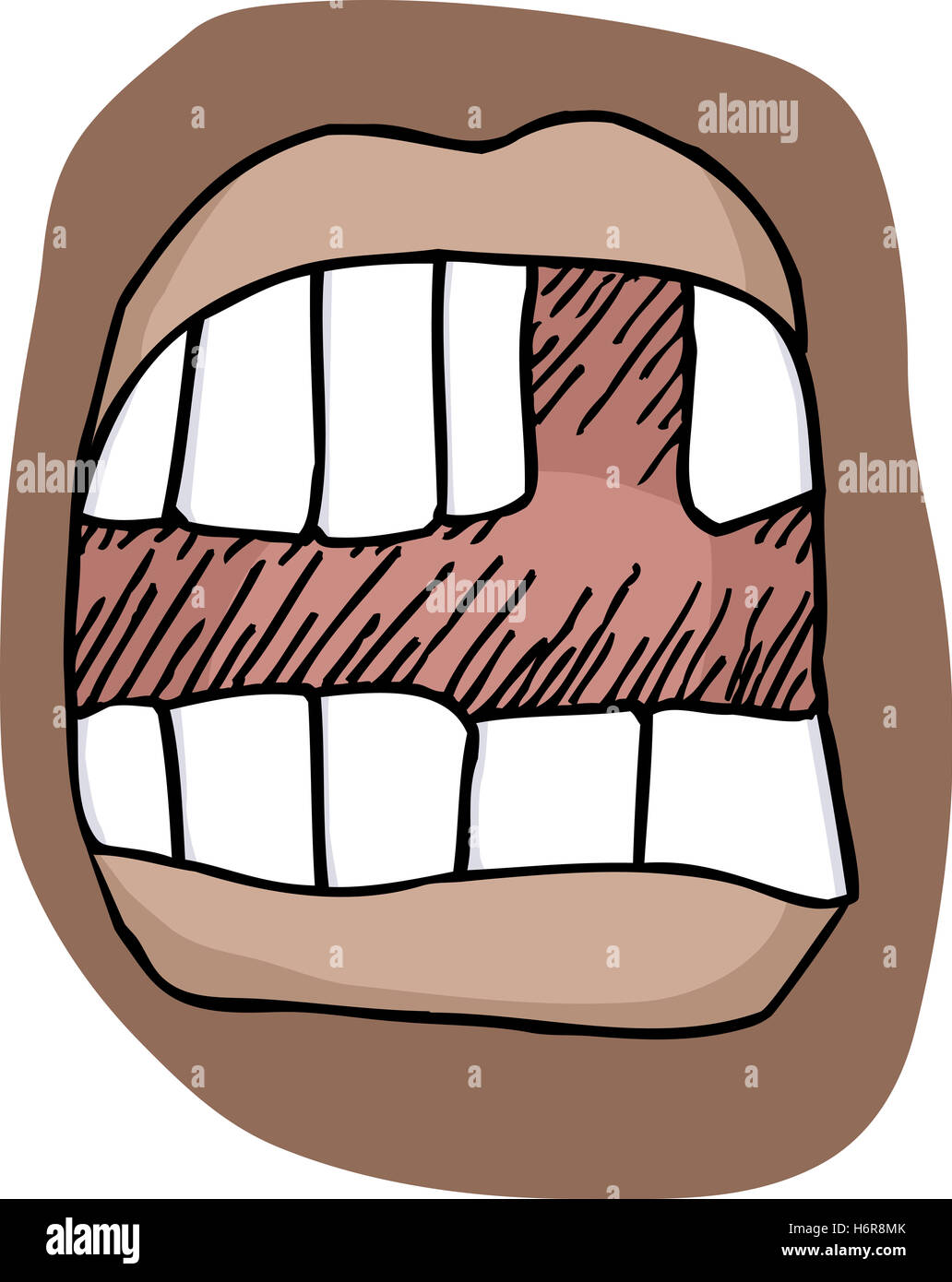 Decay teeth drawing hi-res stock photography and images - Alamy