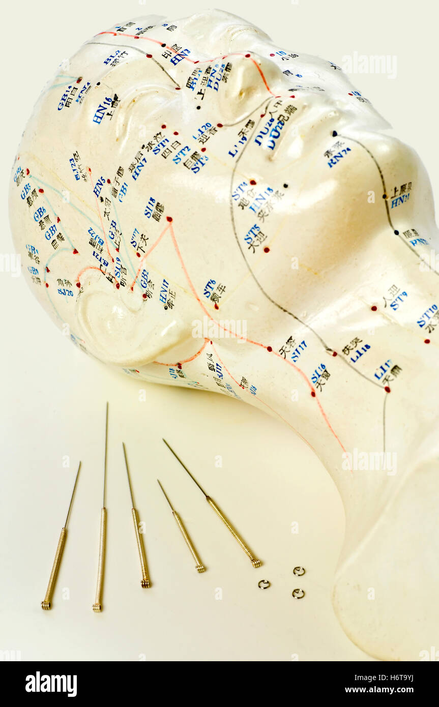 Acupuncture china hires stock photography and images Alamy