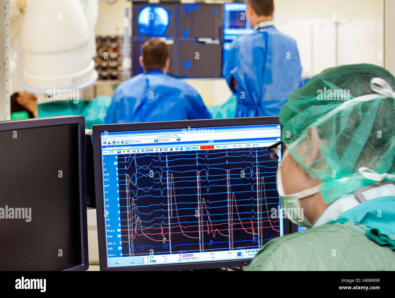 A doctor monitoring a laparoscopic heart procedure in hospital surgery room with a patient under a scanner. Stock Photo