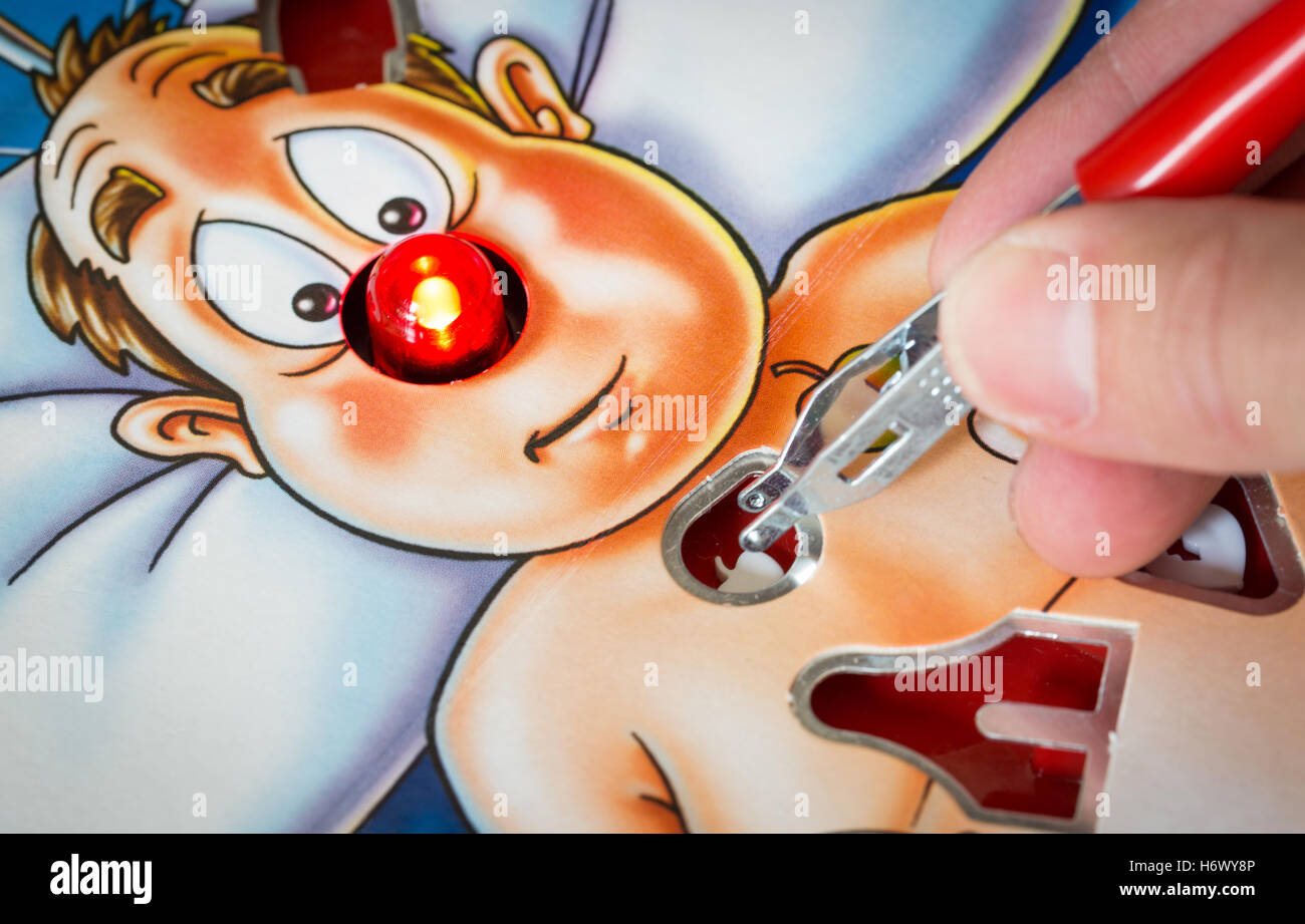 Operation Board Game with the patient's nose flashing Stock Photo