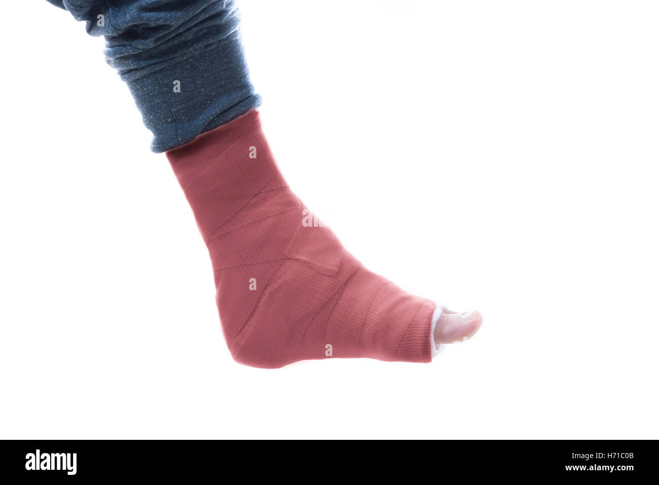 Fiberglass cast on broken ankle hires stock photography and images Alamy
