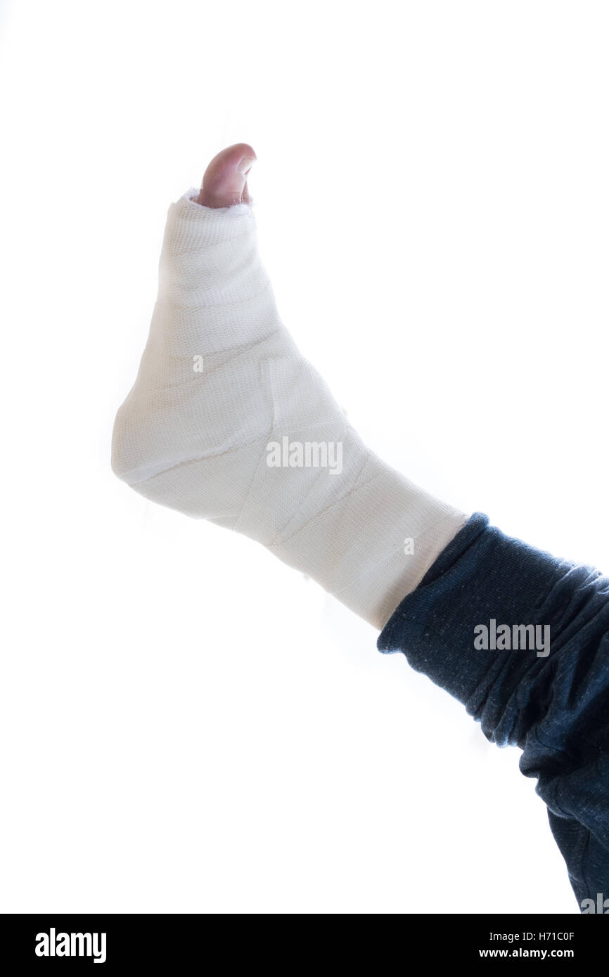 White plaster and fiberglass leg cast worn by a young man(isolated on white Stock Photo Alamy