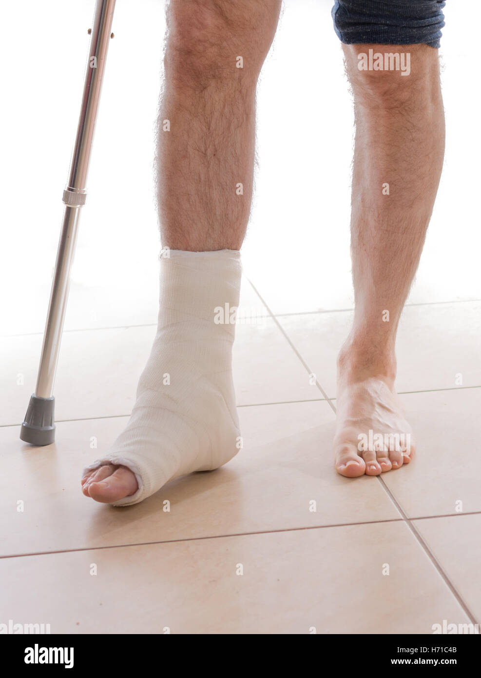 Young man with a broken ankle and a white cast on his leg, walking on crutches (isolated on white) Stock Photo