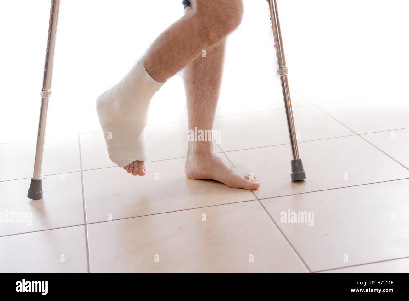Young man with a broken ankle and a white cast on his leg, walking on crutches (isolated on white) Stock Photo