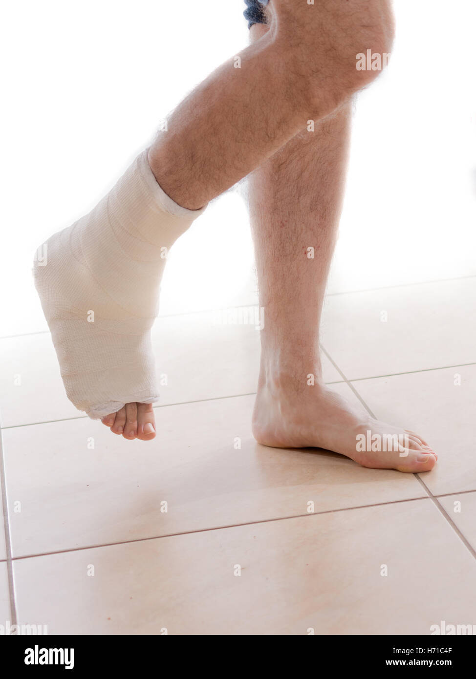 Broken ankle hi-res stock photography and images - Alamy