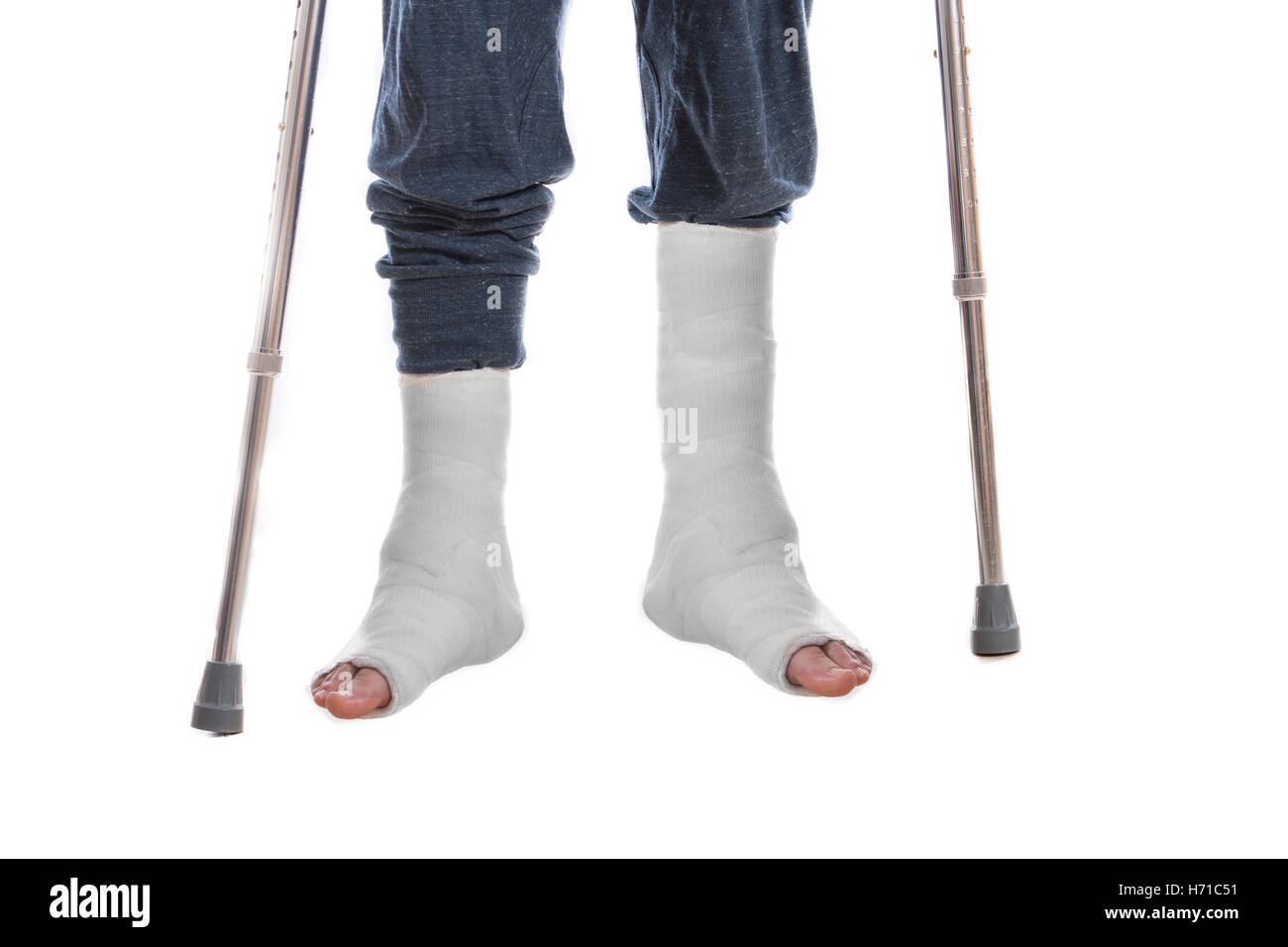 Young man with two broken ankles and dual white casts on his legs