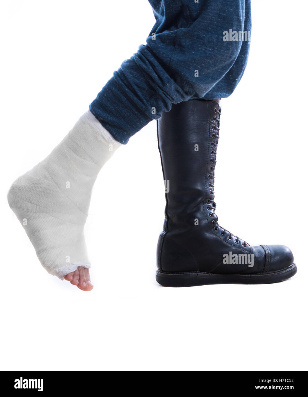 Leg cast and combat boot (war and injury) one foot in a cast and one